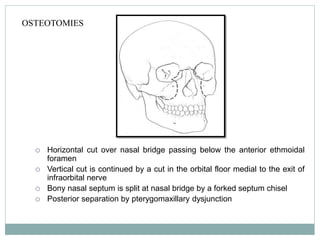 OSTEOTOMIES
 Horizontal cut over nasal bridge passing below the anterior ethmoidal
foramen
 Vertical cut is continued by a cut in the orbital floor medial to the exit of
infraorbital nerve
 Bony nasal septum is split at nasal bridge by a forked septum chisel
 Posterior separation by pterygomaxillary dysjunction
 