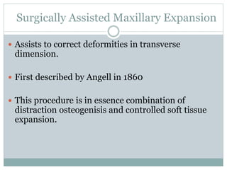 Maxillary Osteotomy Procedures