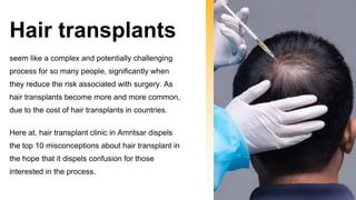 10 myths about hair transplant