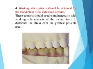 occlusion in rpds | PPTX