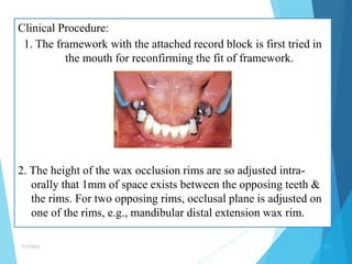 Occlusal Record Rpd occlusion in rpds | PPTX