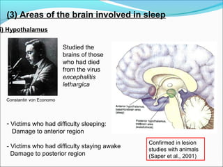 (3) Areas of the brain involved in sleep
i) Hypothalamus
Studied the
brains of those
who had died
from the virus
encephalitis
lethargica
- Victims who had difficulty sleeping:
Damage to anterior region
- Victims who had difficulty staying awake
Damage to posterior region
Constantin von Economo
Confirmed in lesion
studies with animals
(Saper et al., 2001)
 