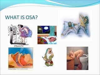 WHAT IS OSA?
 