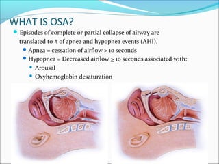 WHAT IS OSA?
Episodes of complete or partial collapse of airway are
translated to # of apnea and hypopnea events (AHI).
Apnea = cessation of airflow > 10 seconds
Hypopnea = Decreased airflow > 10 seconds associated with:
 Arousal
 Oxyhemoglobin desaturation
 