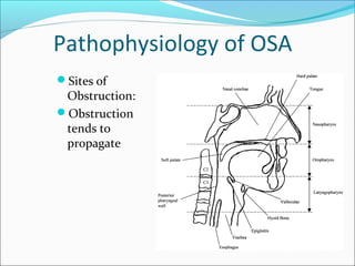 Pathophysiology of OSA
Sites of
Obstruction:
Obstruction
tends to
propagate
 