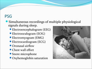 PSG
Simultaneous recordings of multiple physiological
signals during sleep.
Electroencephalogram (EEG)
Electrooculogram (EOG)
Electromyogram (EMG)
Electrocardiogram (ECG)
Oronasal airflow
Chest wall effort
Snore microphone
Oxyhemoglobin saturation
 