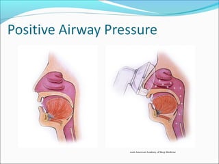 2006 American Academy of Sleep Medicine
 