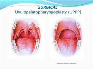 2006 American Academy of Sleep Medicine
 