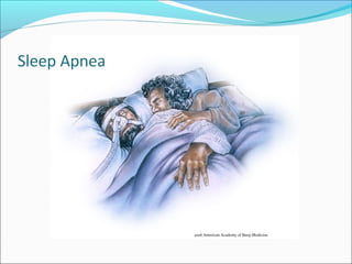 2006 American Academy of Sleep Medicine
 