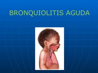 BRONQUIOLITIS AGUDA 