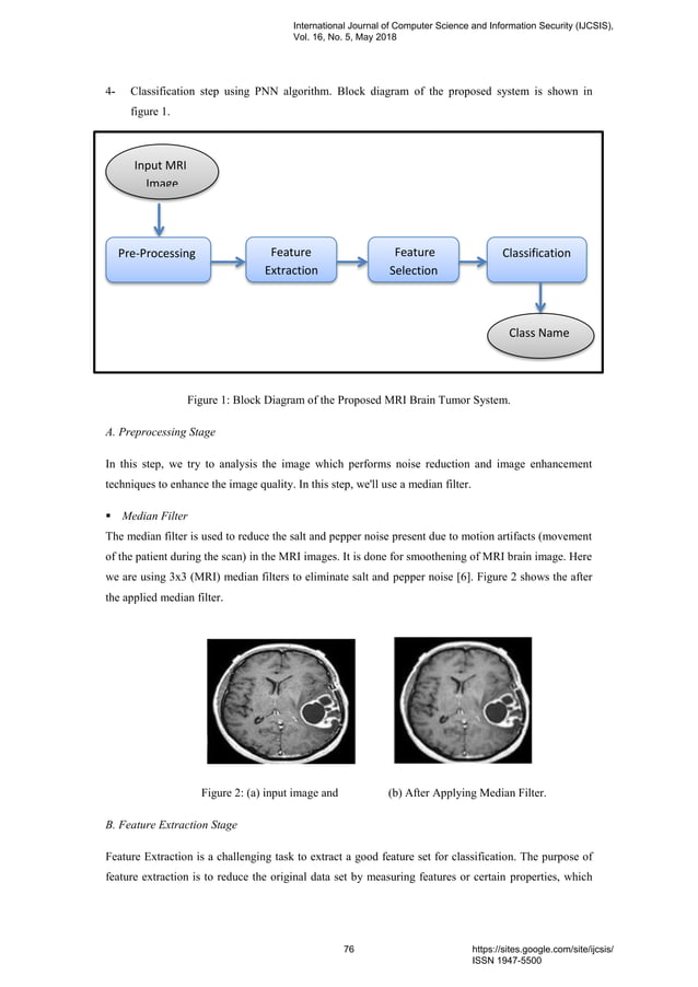 A Hybrid Approach for Classification of MRI Brain Tumors Using Genetic ...