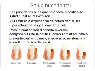 Salud bucodental
Las prioridades a las que se aboca la política de
salud bucal en México son
 Disminuir la experiencia de caries dental, las
periodontopatías y el cáncer bucal,
Para lo cual se han diseñado diversos
componentes de la política, como son: el educativo
preventivo en escolares, el educativo asistencial y
el de fluoruración de la sal
 