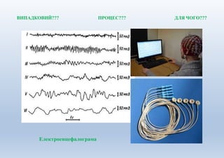 ВИПАДКОВИЙ??? ПРОЦЕС??? ДЛЯ ЧОГО???
Електроенцефалограма
 