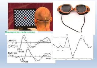 Зіпвавлоло
Викликані потенціали мозку
 