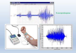 Електроміограма
 