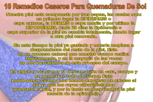 10 remedios caseros para quemaduras de sol imagenes 10 remedios caseros para quemaduras de sol imagenes