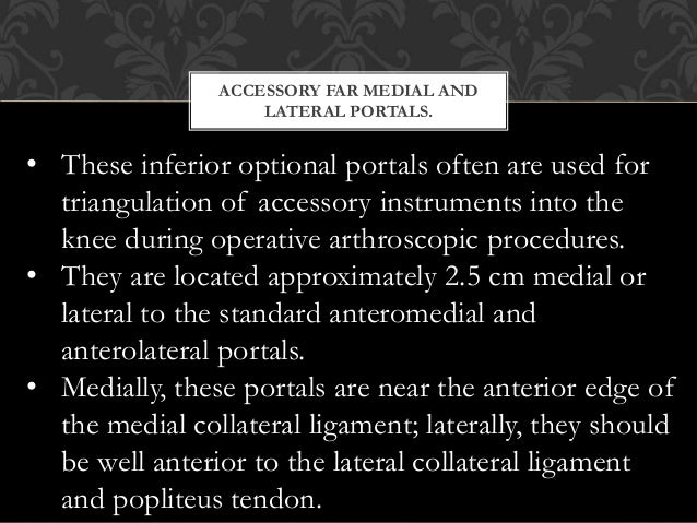Arthroscopic Anatomy Of The Knee Musculoskeletal Key