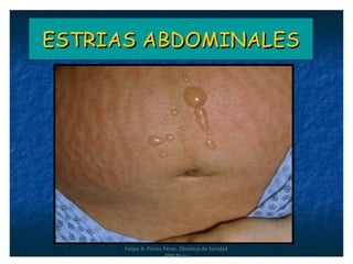 Felipe A. Flores Pérez. Obstetra de Sanidad
PNP Piura
 