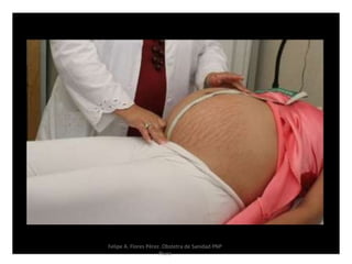 Felipe A. Flores Pérez. Obstetra de Sanidad PNP
Piura
 