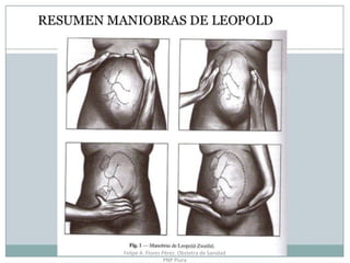 Felipe A. Flores Pérez. Obstetra de Sanidad
PNP Piura
 