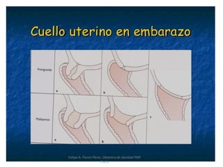 Felipe A. Flores Pérez. Obstetra de Sanidad PNP
Piura
 
