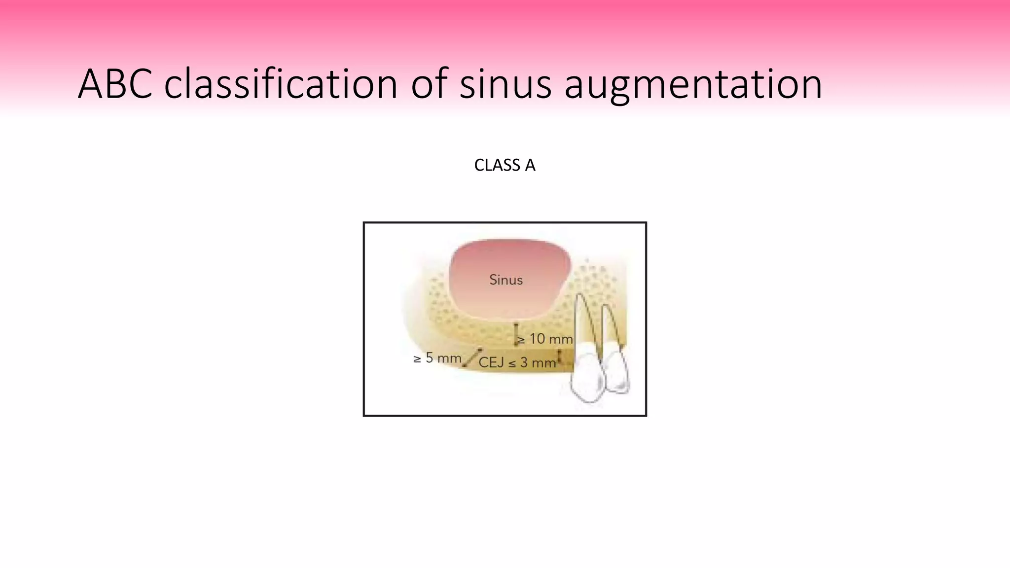 10 SINUS LIFT PROCEDURES seminar 10.pptx