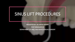 SINUS LIFT PROCEDURES
PRESENTED BY- DR.SNEHA RATHEE
POST GRADUATE III
DEPARTMENT OF ORAL AND MAXILLOFACIAL SURGERY
 