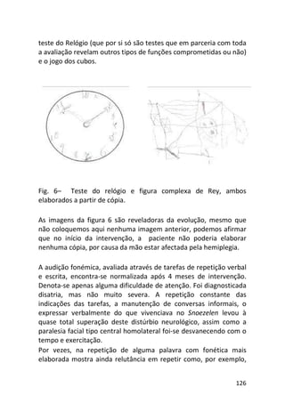 126
teste do Relógio (que por si só são testes que em parceria com toda
a avaliação revelam outros tipos de funções comprometidas ou não)
e o jogo dos cubos.
Fig. 6– Teste do relógio e figura complexa de Rey, ambos
elaborados a partir de cópia.
As imagens da figura 6 são reveladoras da evolução, mesmo que
não coloquemos aqui nenhuma imagem anterior, podemos afirmar
que no início da intervenção, a paciente não poderia elaborar
nenhuma cópia, por causa da mão estar afectada pela hemiplegia.
A audição fonémica, avaliada através de tarefas de repetição verbal
e escrita, encontra-se normalizada após 4 meses de intervenção.
Denota-se apenas alguma dificuldade de atenção. Foi diagnosticada
disatria, mas não muito severa. A repetição constante das
indicações das tarefas, a manutenção de conversas informais, o
expressar verbalmente do que vivenciava no Snoezelen levou à
quase total superação deste distúrbio neurológico, assim como a
paralesia facial tipo central homolateral foi-se desvanecendo com o
tempo e exercitação.
Por vezes, na repetição de alguma palavra com fonética mais
elaborada mostra ainda relutância em repetir como, por exemplo,
 