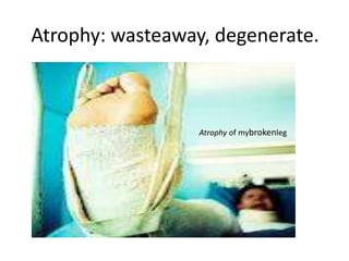 Atrophy: wasteaway, degenerate.



                  Atrophy of mybrokenleg
 