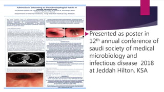 Presented as poster in
12th annual conference of
saudi society of medical
microbiology and
infectious disease 2018
at Jeddah Hilton. KSA
 