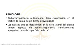 RADIOLOGIA:
• Radiotransparencia redondeada, bien circunscrita, en el
vértice de la raíz de un diente desvitalizado
• Los quistes que se desarrollan en la cara lateral del diente
tienen aspecto de radiotransparencia semicirculares
apoyados contra la superficie de la raíz
Philip J, et al (2004). Patología oral y maxilofacial contemporáneo. Elseviier Mosby, Ed. 2.
 