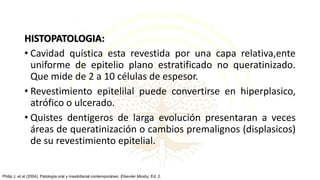 HISTOPATOLOGIA:
• Cavidad quística esta revestida por una capa relativa,ente
uniforme de epitelio plano estratificado no queratinizado.
Que mide de 2 a 10 células de espesor.
• Revestimiento epitelilal puede convertirse en hiperplasico,
atrófico o ulcerado.
• Quistes dentigeros de larga evolución presentaran a veces
áreas de queratinización o cambios premalignos (displasicos)
de su revestimiento epitelial.
Philip J, et al (2004). Patología oral y maxilofacial contemporáneo. Elseviier Mosby, Ed. 2.
 
