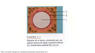 Philip J, et al (2004). Patología oral y maxilofacial contemporáneo. Elseviier Mosby, Ed. 2.
 