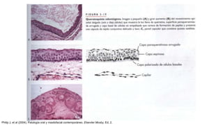 Philip J, et al (2004). Patología oral y maxilofacial contemporáneo. Elseviier Mosby, Ed. 2.
 