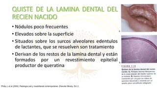 QUISTE DE LA LAMINA DENTAL DEL
RECIEN NACIDO
• Nódulos poco frecuentes
• Elevados sobre la superficie
• Situados sobre los surcos alveolares edentulos
de lactantes, que se resuelven son tratamiento
• Derivan de los restos de la lamina dental y están
formados por un revestimiento epitelial
productor de queratina
Philip J, et al (2004). Patología oral y maxilofacial contemporáneo. Elseviier Mosby, Ed. 2.
 