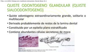 QUISTE ODONTOGENO GLANDULAR (QUISTE
SIALOODONTOGENO)
• Quiste odontogeno extraordinariamente grande, solitario o
multilocular
• Derivado probablemente de restos de la lamina dental
• Constituido por un epitelio plano estratificado
• Contiene abundantes células secretoras de moco
Philip J, et al (2004). Patología oral y maxilofacial contemporáneo. Elseviier Mosby, Ed. 2.
 