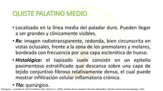 QUISTE PALATINO MEDIO
• Localizado en la línea media del paladar duro. Pueden llegar
a ser grandes y clínicamente visibles.
• Rx: imagen radiotransparente, redonda, bien circunscrita en
vistas oclusales, frente a la zona de los premolares y molares,
bordeada con frecuencia por una capa esclerótica de hueso.
• Histológico: el tapizado suele consistir en un epitelio
pavimentoso estratificado que descansa sobre una capa de
tejido conjuntivo fibroso relativamente denso, el cual puede
mostrar infiltración celular inflamatoria crónica.
• Tto: quirúrgico.
Rodríguez L, Guiardinu R, Arte M, & Blanco Ruiz, Antonio O.. (2006). Quistes de los maxilares: Revisión bibliográfica. Revista Cubana de Estomatología, 43(4)
 