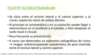 QUISTE GLOBULOMAXILAR
• Se sitúa entre el incisivo lateral y el canino superior, y al
crecer, separa las raíces de ambos dientes.
• Al principio es asintomático y en su evolución puede llegar a
exteriorizarse en el vestíbulo o el paladar, o bien desplazar el
suelo nasal o sinusal.
• Poco frecuente su presentación.
• A veces son detectados en exámenes radiográficos de rutina
→ imagen radiotransparente característica de pera invertida
entre el incisivo lateral y canino superior.
Rodríguez L, Guiardinu R, Arte M, & Blanco Ruiz, Antonio O.. (2006). Quistes de los maxilares: Revisión bibliográfica. Revista Cubana de Estomatología, 43(4)
 