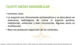QUISTE MEDIO MANDIBULAR
• Lesiones raras.
• La mayoría son clínicamente asintomáticas y se descubren en
exámenes radiológicos de rutina → aspecto quístico,
radiolúcido, unilocular y bien circunscrito. Algunas veces es
multilocular.
• Rara vez producen expansión de las corticales.
Rodríguez L, Guiardinu R, Arte M, & Blanco Ruiz, Antonio O.. (2006). Quistes de los maxilares: Revisión bibliográfica. Revista Cubana de Estomatología, 43(4)
 