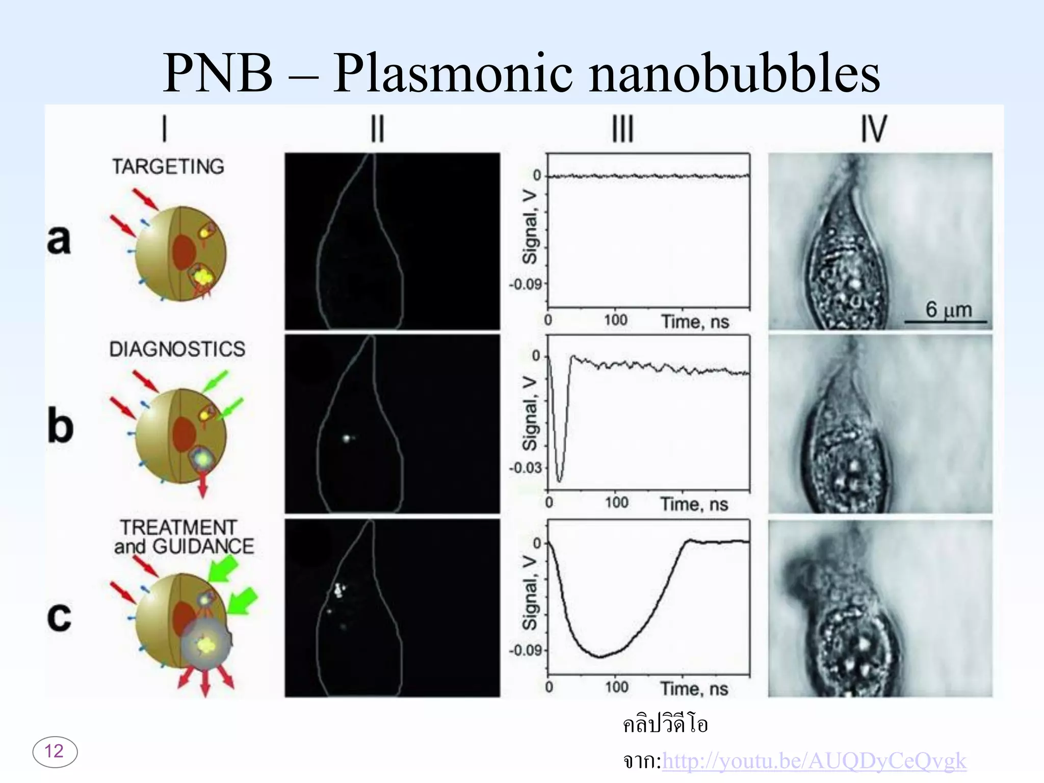 12
คลิปวิดีโอ
จาก:http://youtu.be/AUQDyCeQvgk
PNB – Plasmonic nanobubbles
 