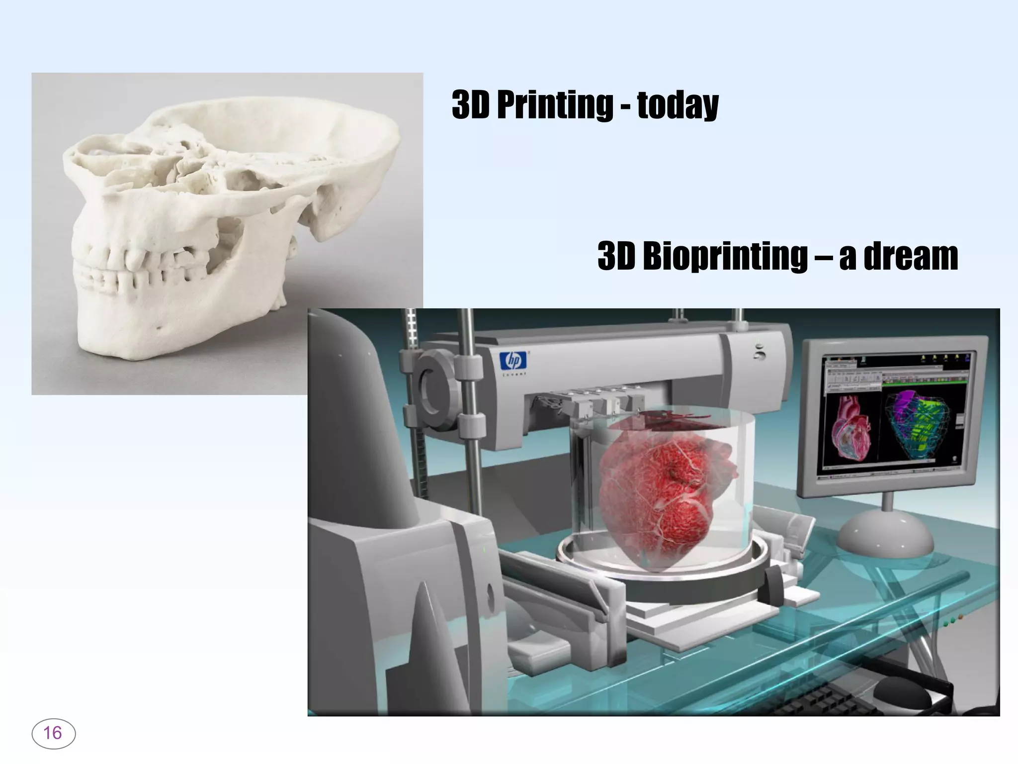 16
3D Printing - today
3D Bioprinting – a dream
 