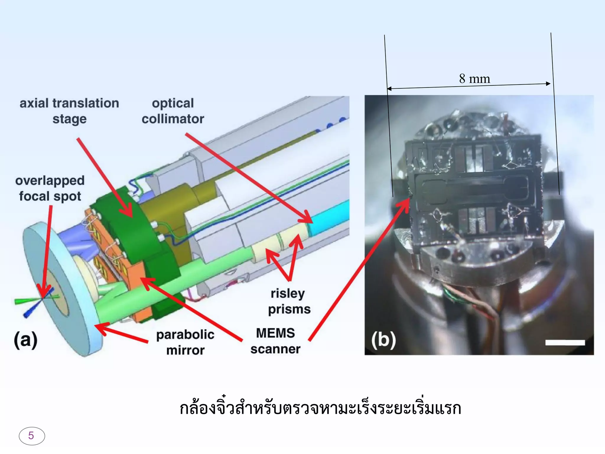5
กล้องจิ๋วสำหรับตรวจหำมะเร็งระยะเริ่มแรก
8 mm
 