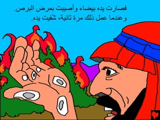 ‫ﻓﺼﺎرت ﻳﺪﻩ ﺏﻴﻀﺎء وأﺹﻴﺒﺖ ﺏﻤﺮض اﻟﺒﺮص.‬
    ‫وﻋﻨﺪﻣﺎ ﻋﻤﻞ ذﻟﻚ ﻣﺮة ﺛﺎﻥﻴﺔ، ُﻔﻴﺖ ﻳﺪﻩ.‬
            ‫ﺵ‬
 