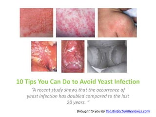 10 Tips You Can Do to Avoid Yeast Infection
     “A recent study shows that the occurrence of
   yeast infection has doubled compared to the last
                       20 years. “
                          Brought to you by YeastInfectionReviewss.com
 