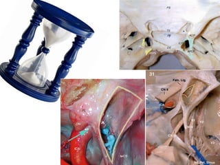 Clinoid has three roots of attachment
1. Anteriror root = Anterior Clinoid process attachemnt to planum
2. Posterior root = Optic struct = L-OCR
3. 3rd root = Anterior Clinoid process attachment to Lesser wing of sphenoid
 