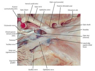 1. SOF present between two structs
2. OS [ optic struct separates optic canal from SOF ]
 