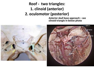 Anterior clinoid process [ ACP ] has 3 roots of attachements :
1. Anterior root – ACP attachment to sphenoid planum medial
to falciform ligament
2. posterior root = OS = L-OCR
3. 3rd root to lesser wing of sphenoid
 