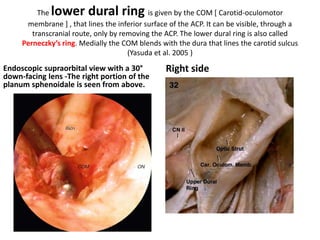 The lower dural ring is given by the COM [ Carotid-oculomotor
membrane ] , that lines the inferior surface of the ACP. It can be visible, through a
transcranial route, only by removing the ACP. The lower dural ring is also called
Perneczky’s ring. Medially the COM blends with the dura that lines the carotid sulcus
(Yasuda et al. 2005 )
Endoscopic supraorbital view with a 30°
down-facing lens -The right portion of the
planum sphenoidale is seen from above.
Right side
 