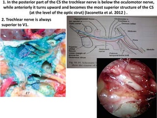 The optic strut has two neural-
facing surfaces( yellow dotted
lines) and one vascular-facing
surface (red dotted line).
[ COM= Lower dural ring – Carotico-
Occulomotor membrane seperates
3rd N from Clinoidal carotid ]
 