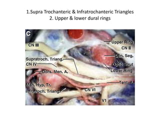 Note the aperture for 3rd nerve & 4th nerve anterior & posterior to
posterior petro-clival fold [ PPCF ]
 